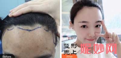 西京医院整形外科窦文婕技术怎么样?擅长项目_案例_费用_门诊时间
