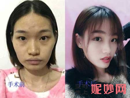 【吴焱秋】北京联合丽格吴焱秋技术怎么样?个人简介-项目-案例-价格-出诊时间