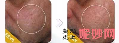 北京联合丽格苏映军医生技术怎么样?个人简介-项目-案例-价格-出诊时间