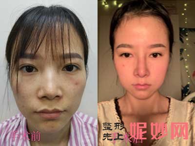 北京联合丽格何照华医生怎么样?个人简介-项目-案例-价格-出诊时间