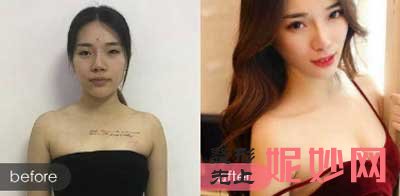 北京联合丽格杨大平医生整形技术好不好?擅长项目-案例-价格-门诊时间