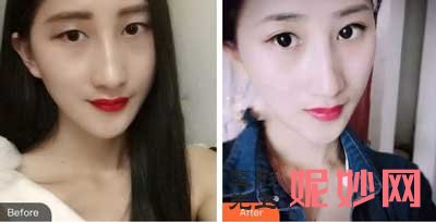 武汉同济医院整形美容外科邓裴怎么样?擅长项目_案例_费用_出诊时间