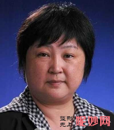 武汉同济医院整形美容外科黄立医生怎么样?案例_价格_门诊时间/预约挂号
