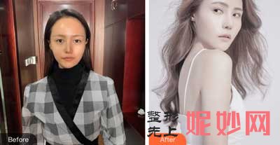 四川娇点医学美容医院文杰怎么样?鼻综合、双眼皮案例,价格,出诊时间/预约电话