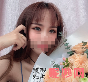 卢尚兵双眼皮怎么样？