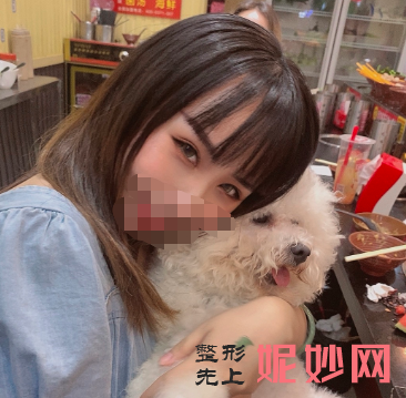 卢尚兵双眼皮怎么样？