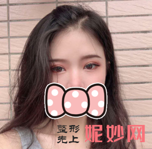 康春雨双眼皮怎么样？