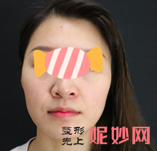 王中秒做线雕怎么样？