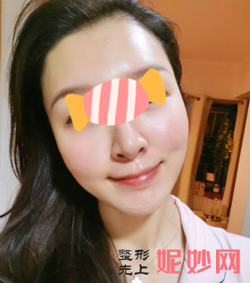 王中秒做线雕怎么样？