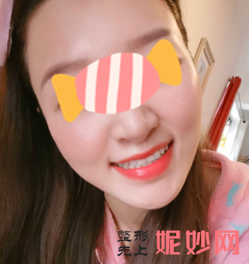 王中秒做线雕怎么样？