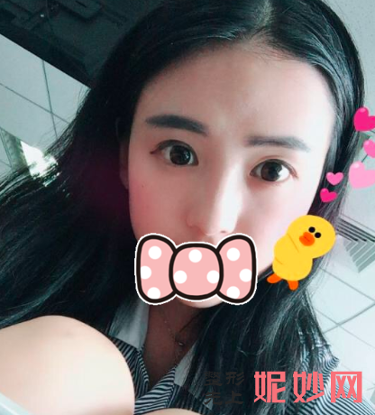 王中秒做线雕多少钱?
