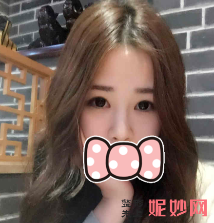 王中秒做线雕会肿吗？