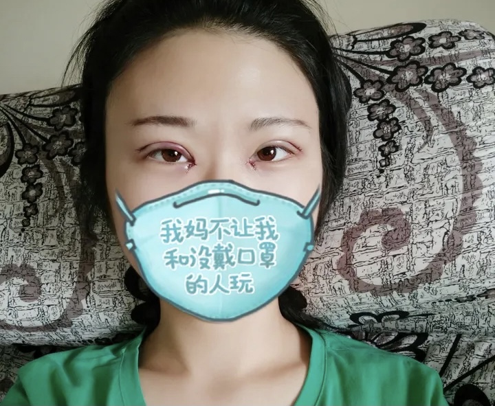 南京艺星汪树杰做眼睛究竟怎么样呢？内附真实案例分享价格