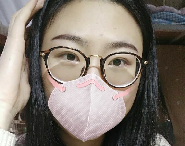 南京艺星汪树杰做眼睛究竟怎么样呢？内附真实案例分享价格