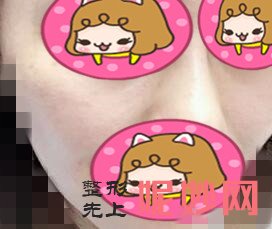 曾广华医生瘦脸怎么样？效果好不好？附医生介绍+案例分享~