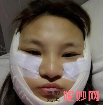 吕京陵颧骨怎么样？效果好吗？附医生介绍+案例分享！！