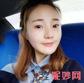 吕京陵颧骨怎么样？效果好吗？附医生介绍+案例分享！！