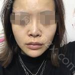 成都仪美美仁医疗美容周仪怎么样?内附案例分享价格表