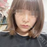 成都仪美美仁医疗美容周仪怎么样?内附案例分享价格表
