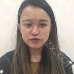 上海伊莱美医疗美容医院怎么样?内附医生介绍价格表