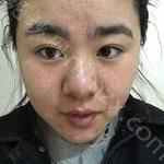北京蕾士悦容医疗美容怎么样？好不好？内附价格表