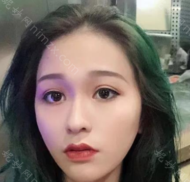 苏州美莱美容医院吴蓉隆鼻好不好？简介_案例分享_较新价格表