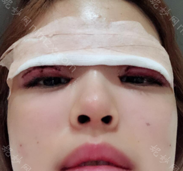 北京知音医疗美容李文波怎么样？简介_坐诊时间_案例分享_价格表