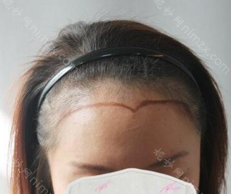 北京碧莲盛医疗美容门诊部怎么样？地址_口碑_案例_价格表