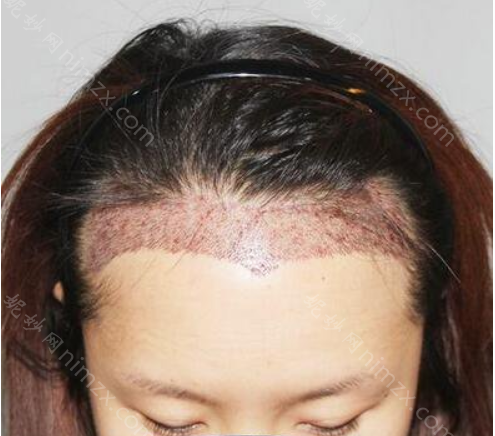 北京碧莲盛医疗美容门诊部怎么样？地址_口碑_案例_价格表