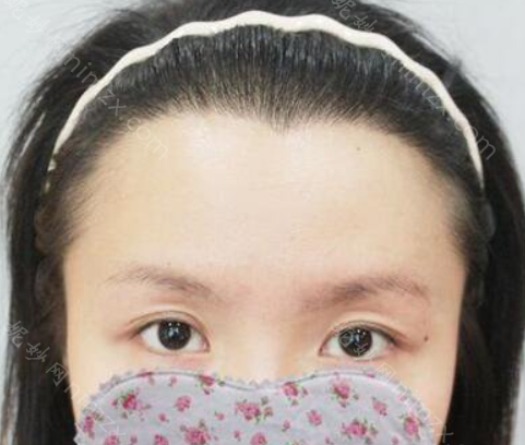 北京碧莲盛医疗美容门诊部怎么样？地址_口碑_案例_价格表