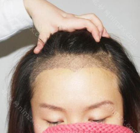 北京碧莲盛医疗美容门诊部怎么样？地址_口碑_案例_价格表