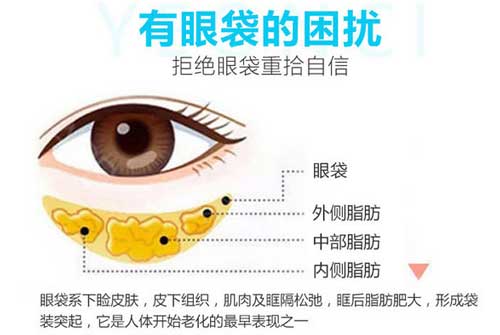 上海九院去眼袋怎么样?九院去眼袋价格及专家介绍