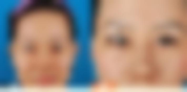 武汉伊美馨整形美容医院-医师团队-价格-案例-位置-口碑怎么样？