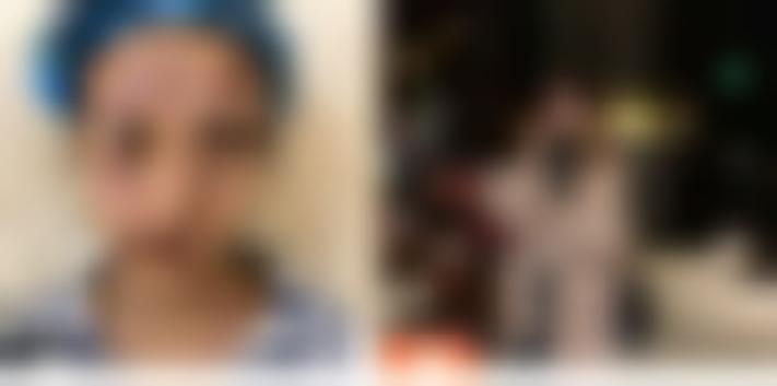 武汉伊美馨整形美容医院-医师团队-价格-案例-位置-口碑怎么样？