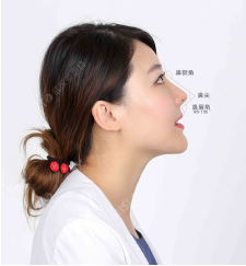 武汉爱思特鼻部修复怎么样？杨水斌院长鼻部修复案例一览