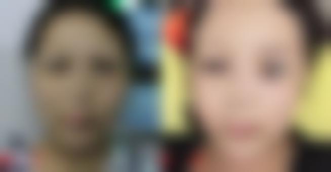 苏州美贝尔医院是三甲医院吗？正规吗口碑怎么样附上案例_价格表
