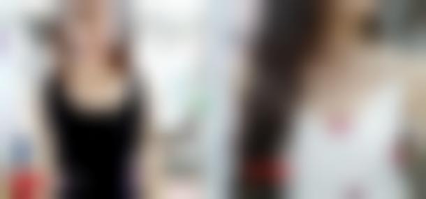 杭州美莱是三甲医院吗?靠谱吗会有失败案例吗?附上真人案例_价格