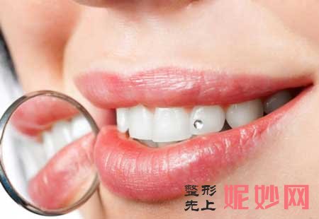 成都做牙齿矫正怎么样?那些情况需要矫正?