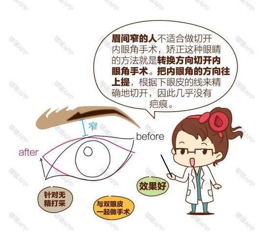 成都医大邓素芳私密整形技术怎么样?阴道紧缩案例,价格,出诊时间