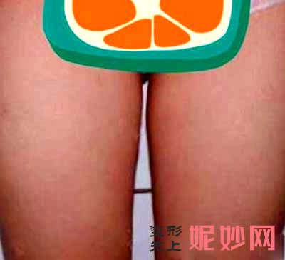 西京医院整形美容科怎么样?在线预约+专家坐诊时间+大腿吸脂案例