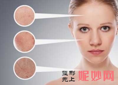 激光祛黄褐斑对皮肤有危害吗?孕期可以做吗?