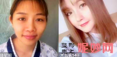 米兰柏羽卢尚兵、康春雨技术怎么样?擅长项目?案例?