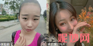 上海华美哪个医生做双眼皮好?侣同帅、杨亚益、许再荣好不好?