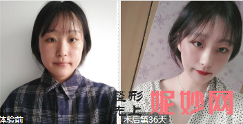 上海华美哪个医生做双眼皮好?侣同帅、杨亚益、许再荣好不好?