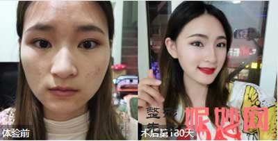 南京金柱翰医生做磨骨怎么样?技术好不好?