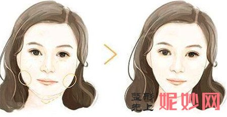 怎样才可以合理运用**打造精致小脸？