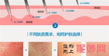 微针是什么？微针对于收缩毛孔是否有实际效果呢？