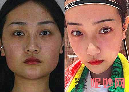 上海何晋龙、李志海、李湘原、洪性范哪个医生做磨骨好？多少钱？