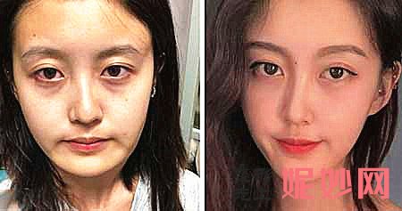 上海何晋龙、李志海、李湘原、洪性范哪个医生做磨骨好？多少钱？