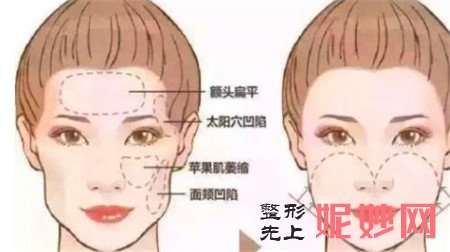 自体脂肪面部填充安全吗？有哪些后遗症需要警惕？